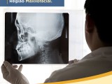 art_post_09_osteomielite
