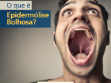 02_post_epidermolise