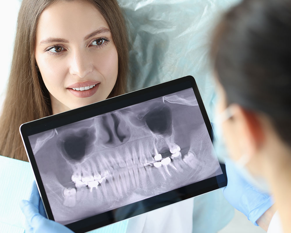 Quando devo tirar o siso? Juliana Búrigo